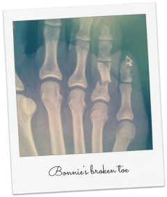 broken bonnie